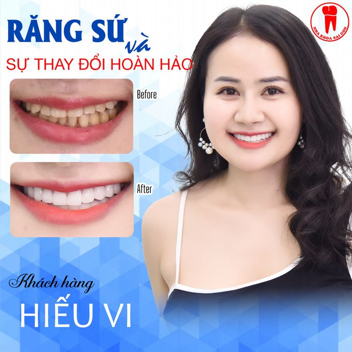 Hình ảnh không gian sang trọng tại Nha Khoa Sài Gòn Phan Thiết