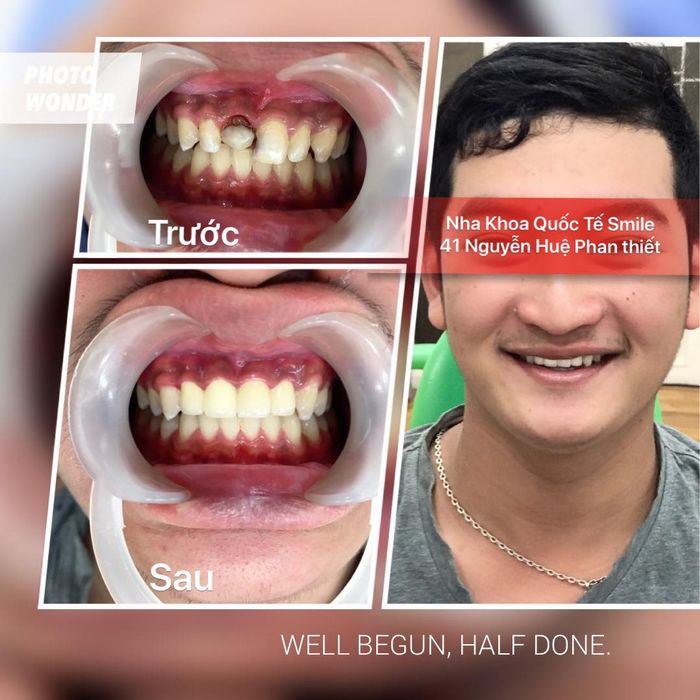 Hình ảnh cơ sở vật chất hiện đại tại Nha Khoa Quốc Tế Smile