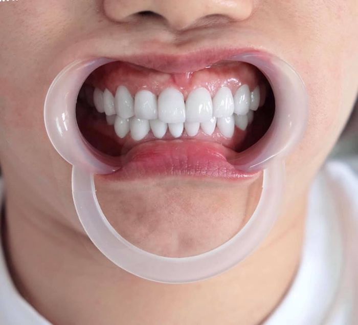 Hình ảnh đội ngũ bác sĩ tận tâm tại Nha Khoa BS Ngọc Anh