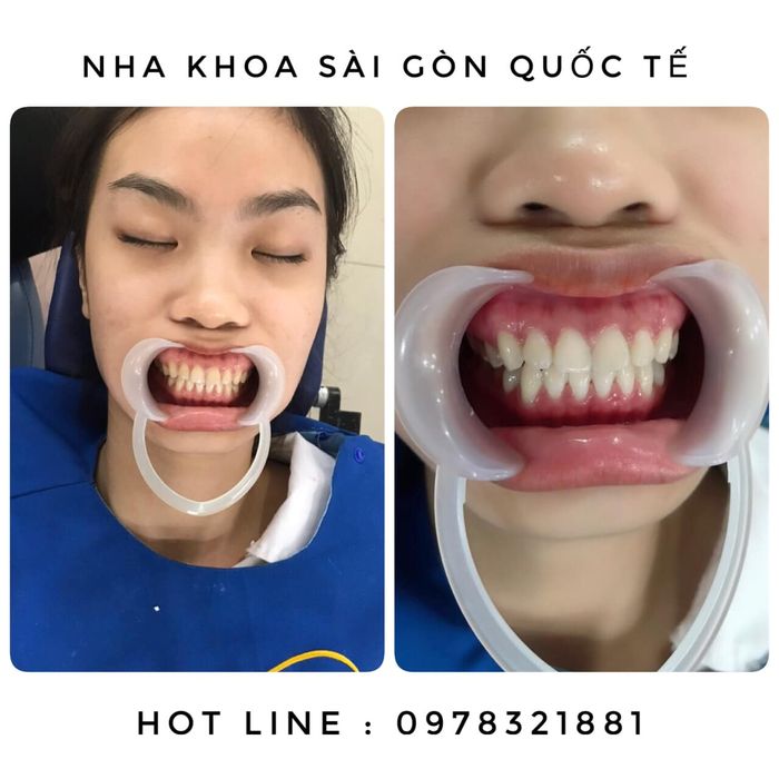 Hình ảnh không gian sang trọng và hiện đại tại Nha Khoa Sài Gòn Quốc Tế Phan Thiết
