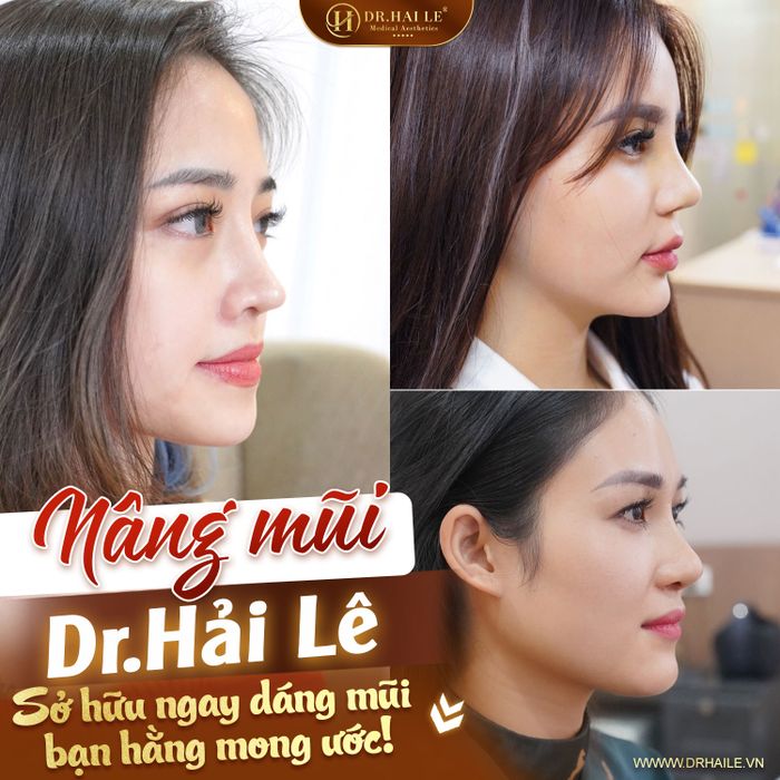 Hình ảnh thực tế khách hàng trải nghiệm dịch vụ tại Viện Thẩm Mỹ Dr.Hải Lê