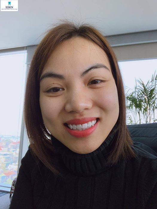 Hình ảnh thực tế tại Nha khoa EDEN Dental Care