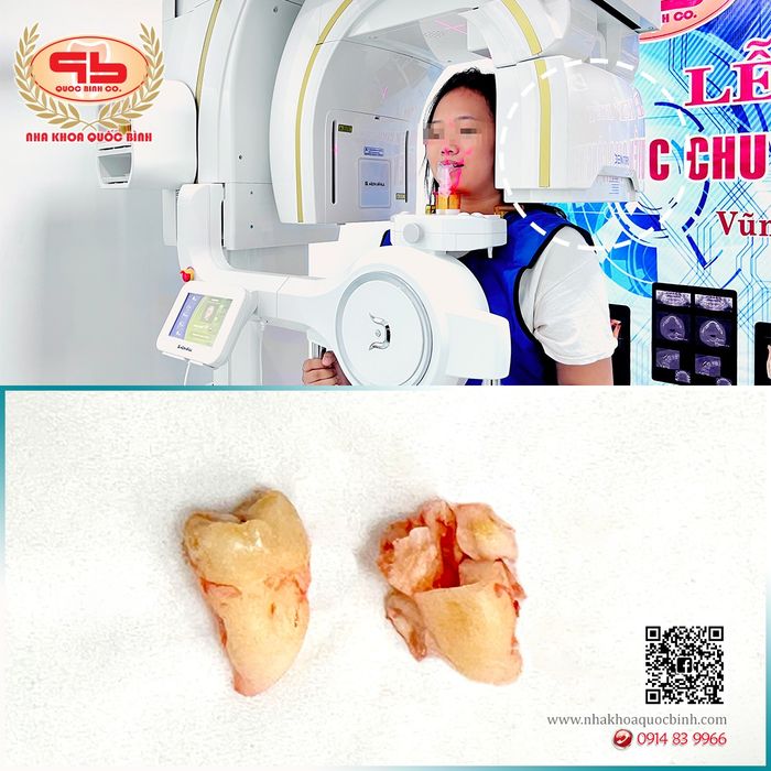Hình ảnh đội ngũ bác sĩ tay nghề cao Nha Khoa Quốc Bình Vũng Tàu