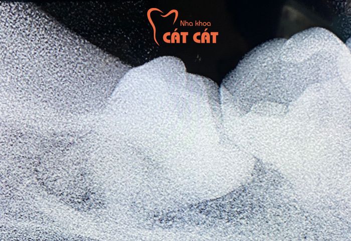 Hình ảnh không gian Nha khoa Cát Cát