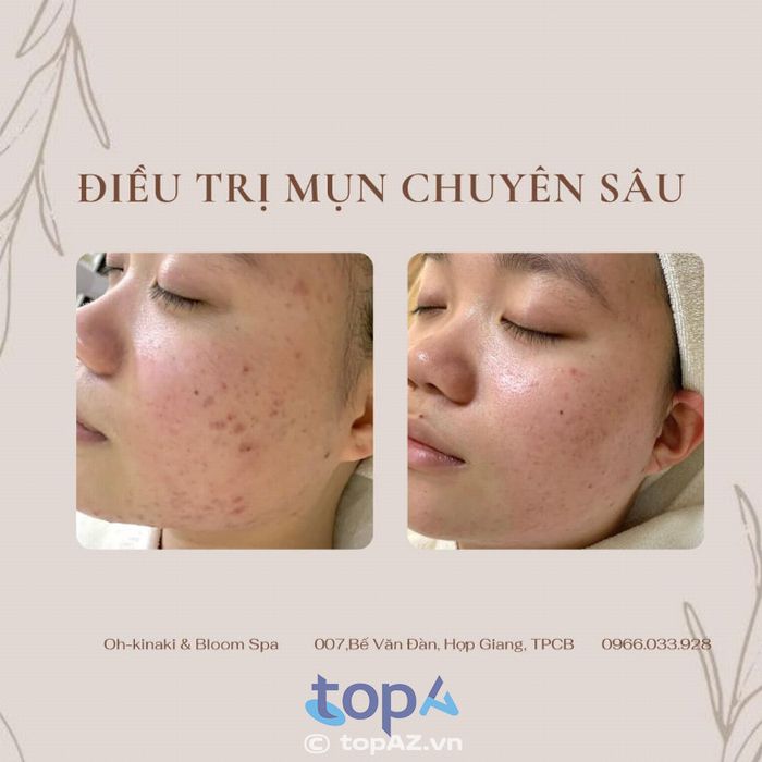 Oh-kinaki Bloom Clinic & Spa - Đỉnh cao nghệ thuật làm đẹp tại TP. Cao Bằng