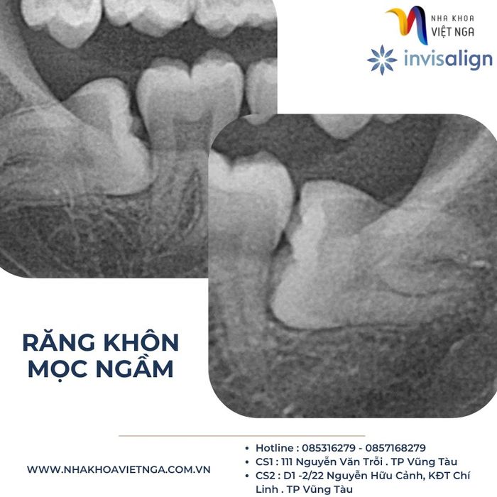 Hình ảnh đội ngũ y bác sĩ chuyên nghiệp Nha Khoa Việt Nga