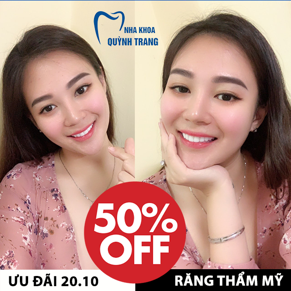 Hình ảnh thực tế quy trình tẩy trắng tại Nha khoa Quỳnh Trang