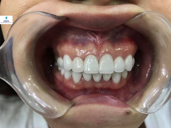 Không gian hiện đại tại Nha khoa EDEN Dental Care