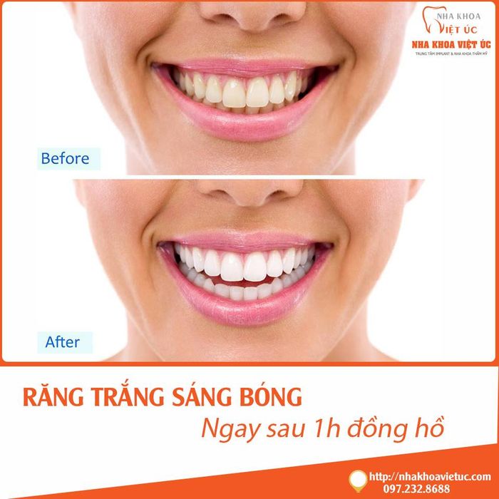 Hình ảnh thực tế Nha khoa Việt Úc