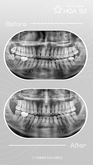 Hình ảnh phòng khám hiện đại tại Nha Khoa Hoa Sứ