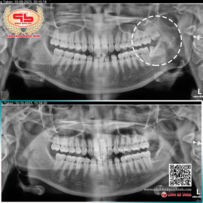 Hình ảnh phòng khám hiện đại tại Nha Khoa Quốc Bình Vũng Tàu