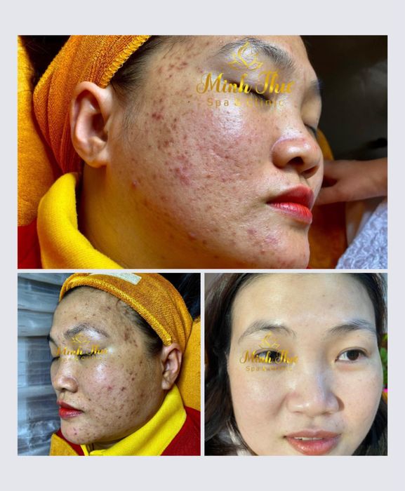 Quy trình chăm sóc da chuyên nghiệp tại Minh Thư Spa
