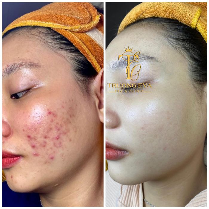 Không gian trị liệu sang trọng tại Trương Eva Spa & Clinic