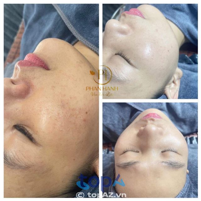 Phan Hạnh Beauty - Kiến tạo nét đẹp hoàn hảo