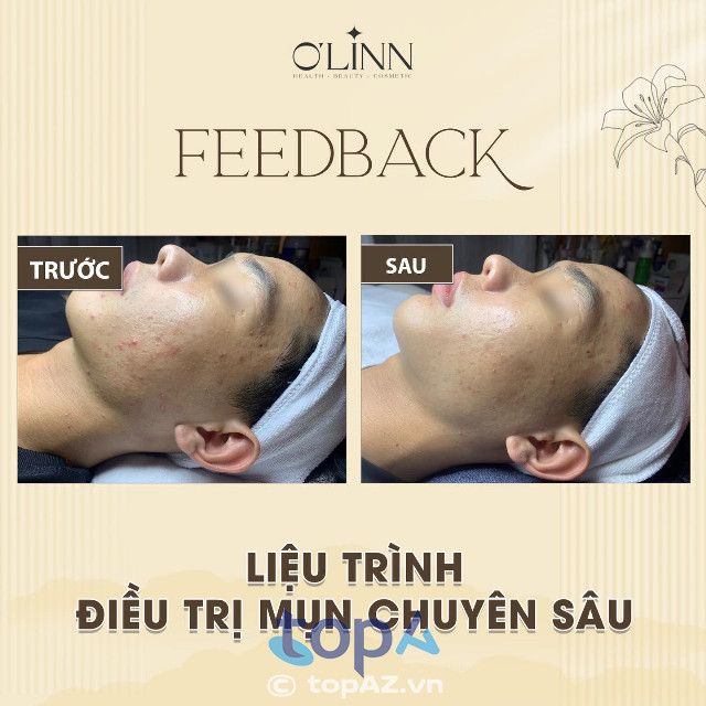 Viện thẩm mỹ O'Linn - Hành trình kiến tạo làn da không tì vết