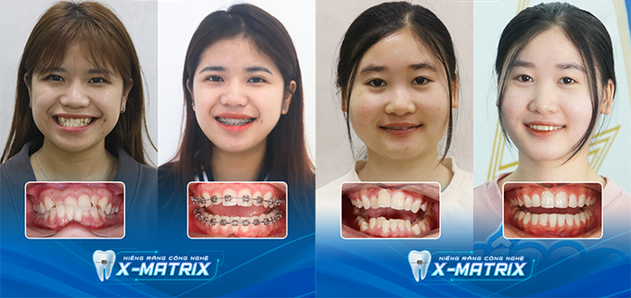 Không gian sang trọng đạt chuẩn 5 sao tại Lạc Việt Intech
