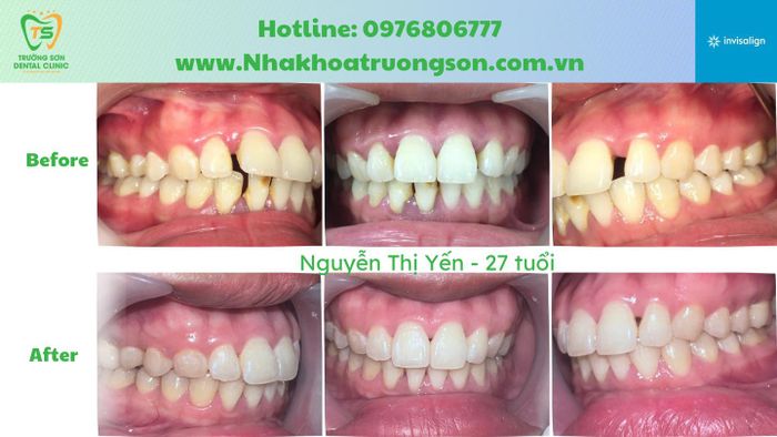Hệ thống trang thiết bị tân tiến tại Nha Khoa Trường Sơn