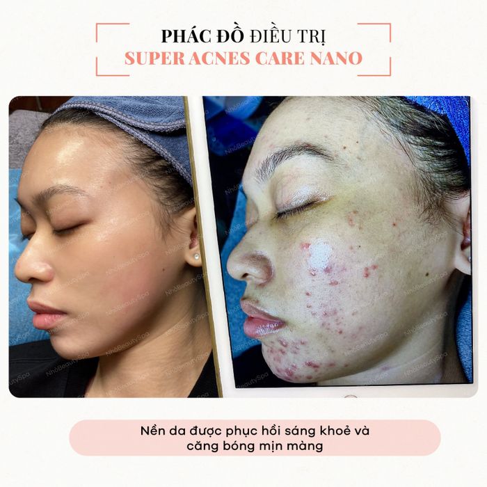 Nhỏ Beauty Spa - Hình ảnh 2: Quy trình chăm sóc da chuyên nghiệp