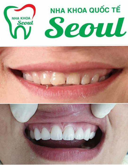 Hệ thống máy móc tiêu chuẩn Hàn Quốc tại Nha Khoa Seoul