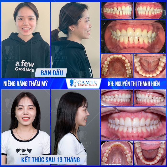 Cơ sở vật chất hiện đại tại Nha Khoa Cẩm Tú