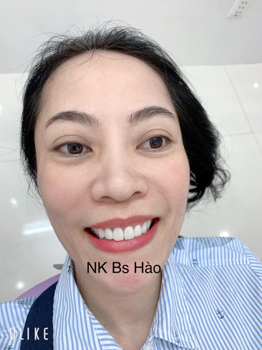 Hệ thống máy móc hiện đại và quy trình chuẩn tại Nha khoa Bác Sĩ Hào