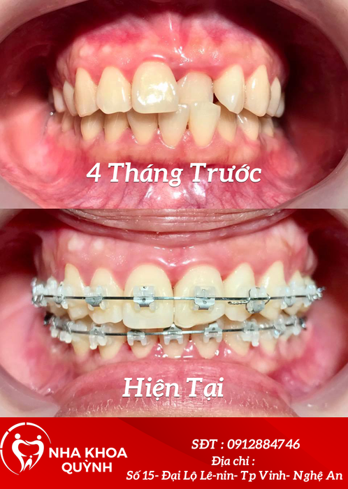 Hình ảnh thực tế Nha khoa Quỳnh