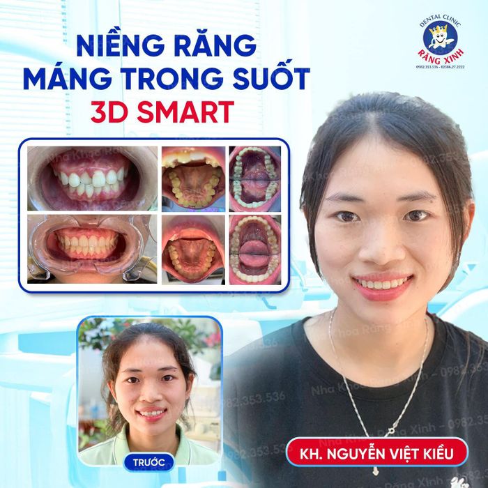 Không gian hiện đại tại Nha khoa Răng Xinh TP. Vinh
