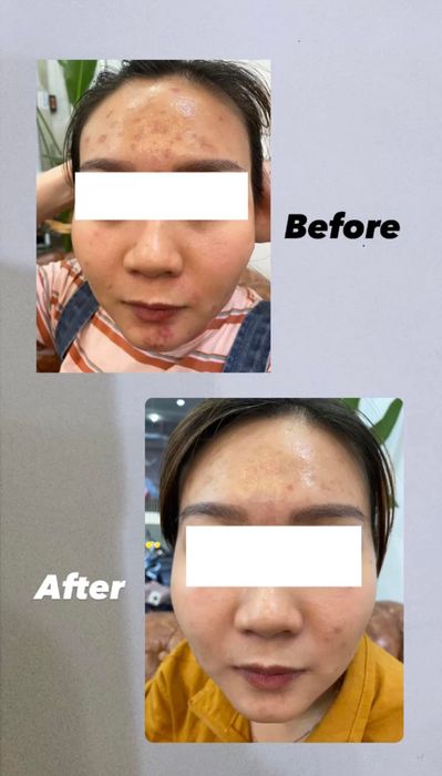 Neo Mermaid Beauty Spa - Hình ảnh 1: Không gian trị liệu đẳng cấp tiên cá