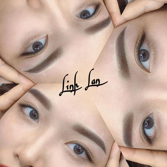 Thẩm Mỹ Linh Lan - Hình ảnh 2