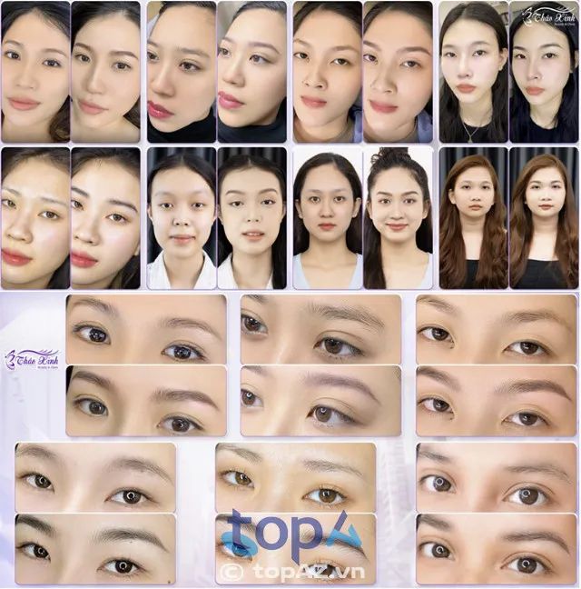 Phun chân mày đẹp tại TP.HCM – Phòng khám Thảo Xinh Beauty Gò Vấp