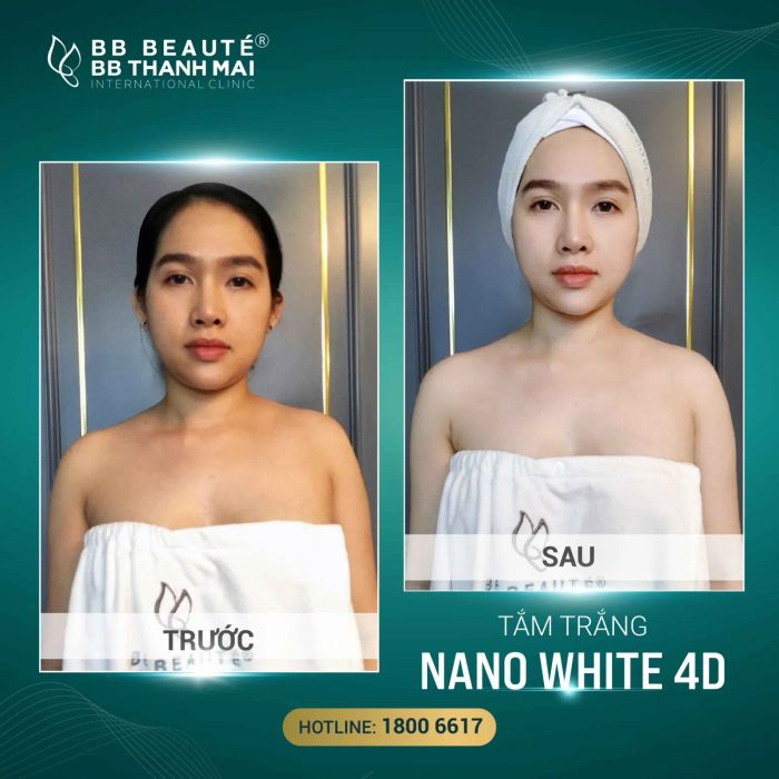 Hình ảnh quy trình tắm trắng công nghệ cao tại BB Beauté