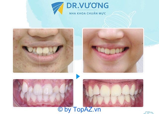 Nha Khoa Dr Vương - Địa chỉ vàng về niềng răng thẩm mỹ