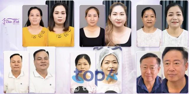 Phun chân mày đẹp tại TP.HCM – Phòng khám Thảo Xinh Beauty Gò Vấp