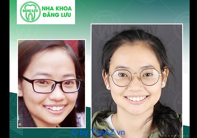 Nha khoa Đăng Lưu - Đẳng cấp dịch vụ hàng đầu