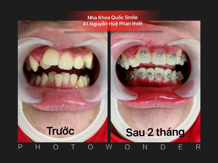 Hình ảnh cơ sở vật chất hiện đại tại Nha Khoa Quốc Tế Smile