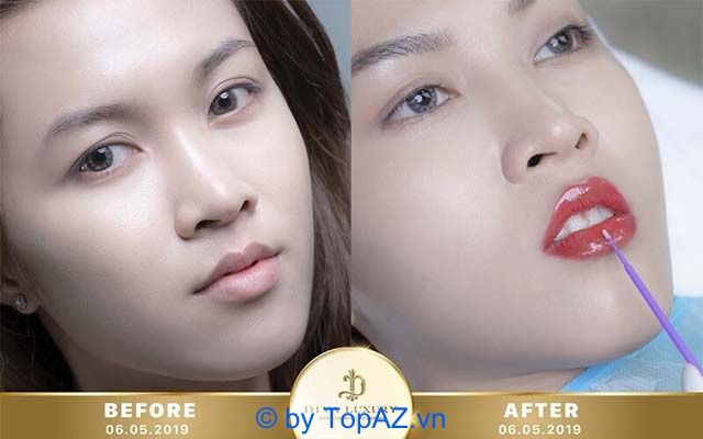 Địa chỉ khử thâm môi uy tín nhất TP.HCM