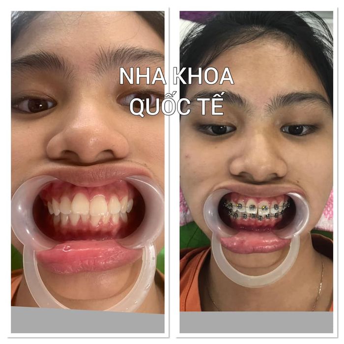 Hình ảnh thực tế về cơ sở vật chất Nha Khoa Quốc Tế Sài Gòn