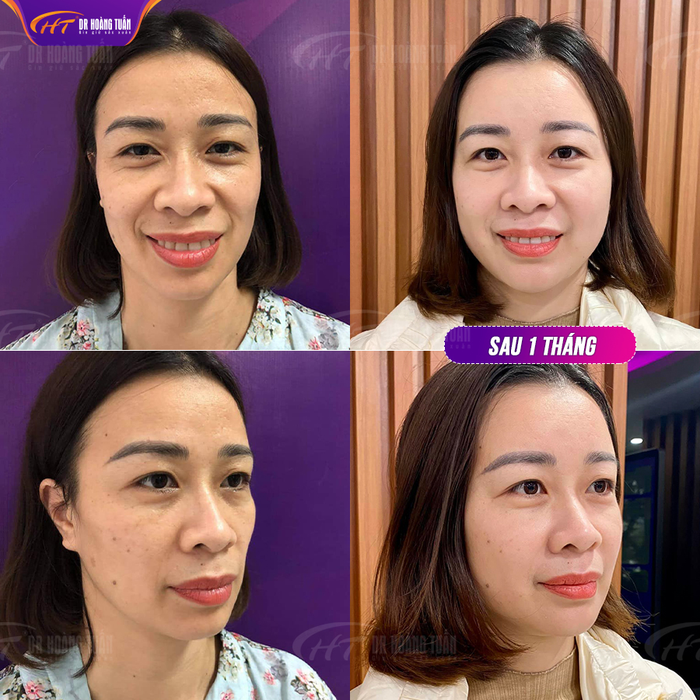 Dr Hoàng Tuấn ảnh 2