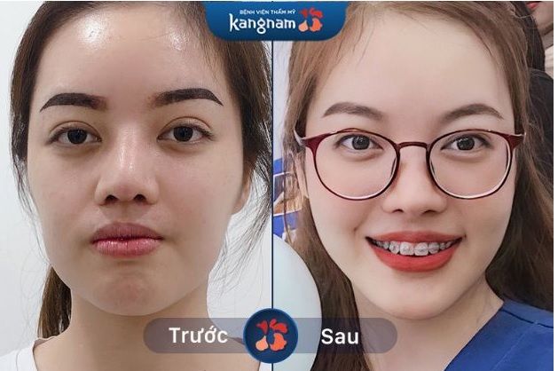 Bệnh viện Thẩm mỹ Kangnam ảnh 1