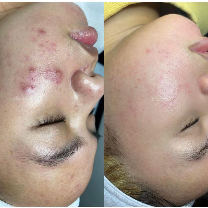 Không gian trị liệu chuẩn y khoa tại 23 House Spa (Ảnh 1)