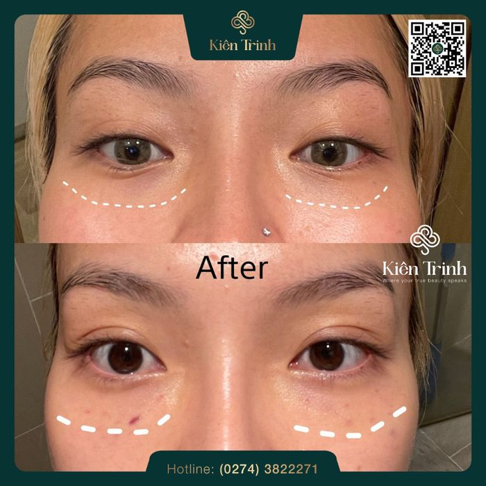 Hình ảnh không gian sang trọng tại Kiên Trinh Beauty Spa