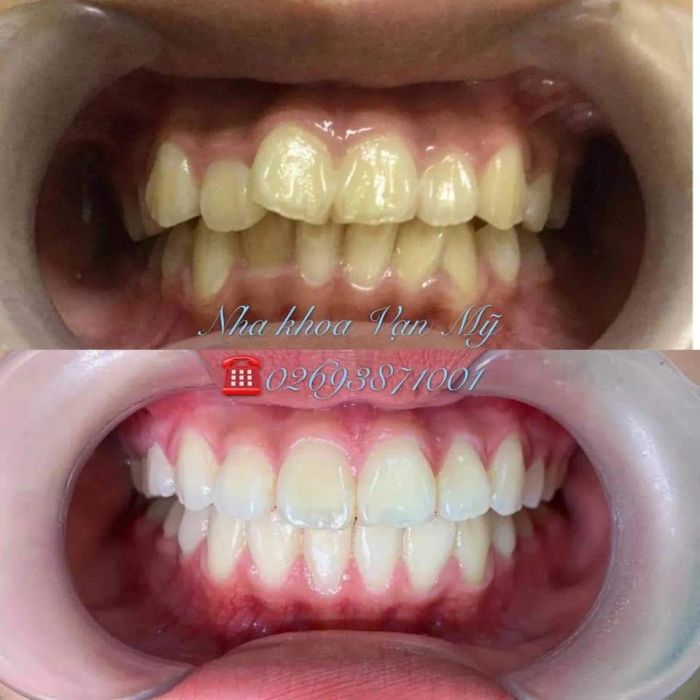 Hình ảnh đội ngũ y bác sĩ tận tâm tại Nha Khoa Vạn Mỹ - Gia Lai