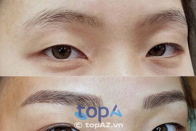 Diva Medispa - Chuẩn mực vàng trong ngành thẩm mỹ