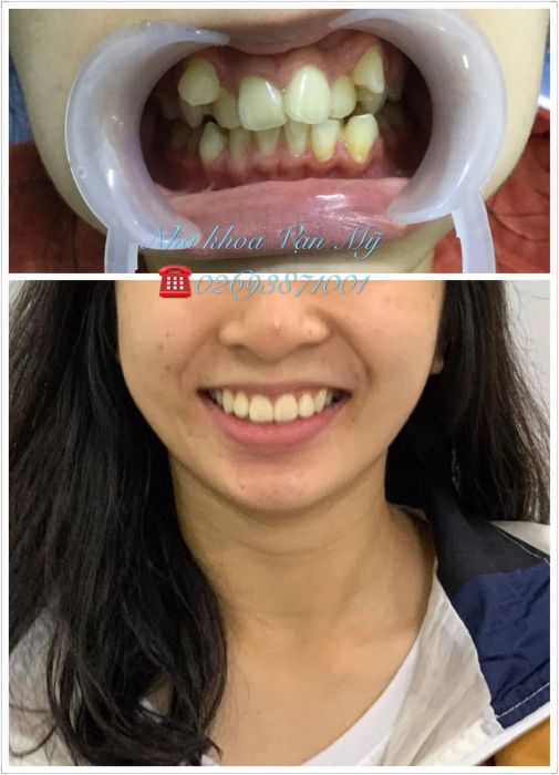 Hình ảnh cơ sở vật chất hiện đại tại Nha Khoa Vạn Mỹ - Gia Lai
