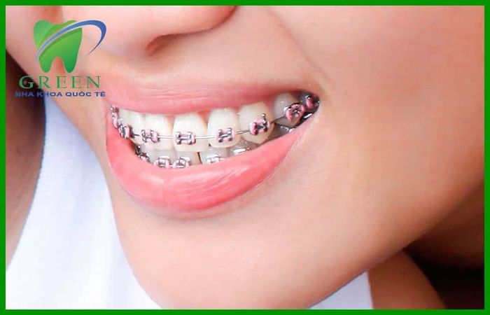 Nha Khoa Quốc Tế GREEN hình ảnh 1