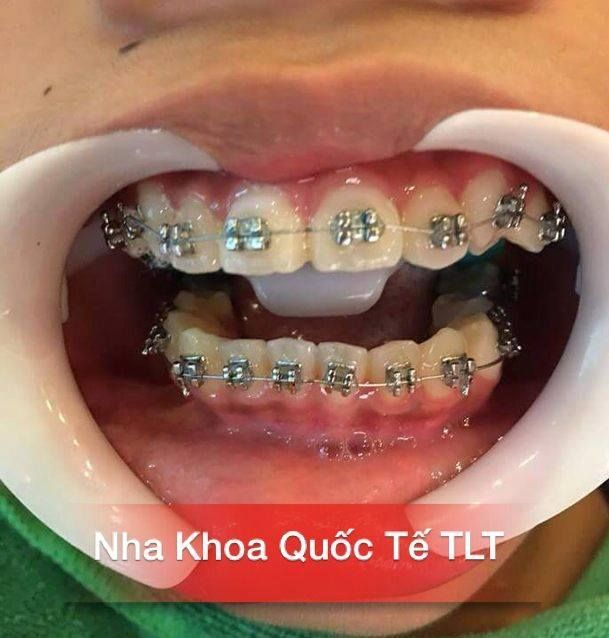 Nha Khoa Gia Khoa TLT hình ảnh 1
