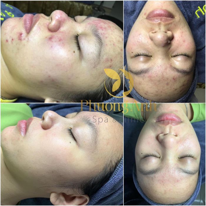 Phương Anh Spa & Clinic ảnh 1