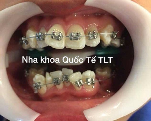 Nha Khoa Gia Khoa TLT hình ảnh 2