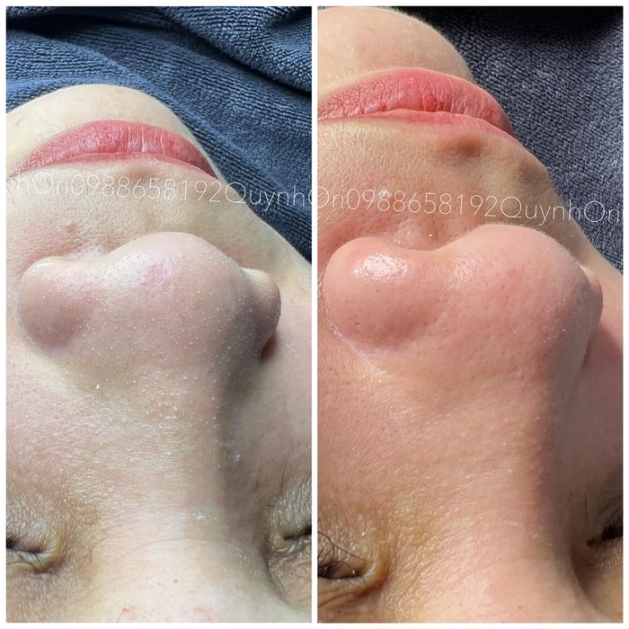 Quỳnh Beauty hình ảnh 2