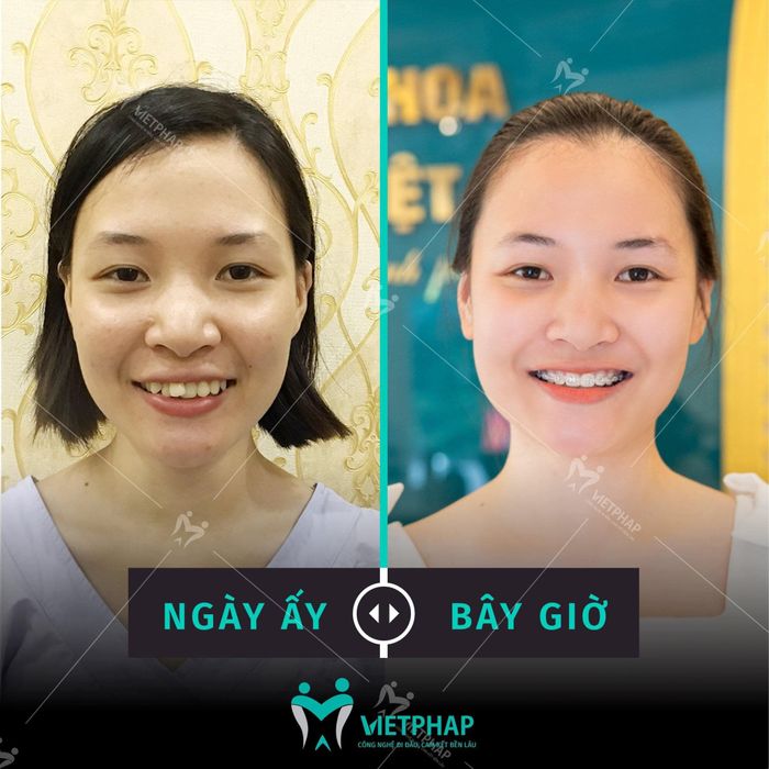 Nha Khoa Quốc Tế Việt Pháp - Uông Bí hình ảnh 2